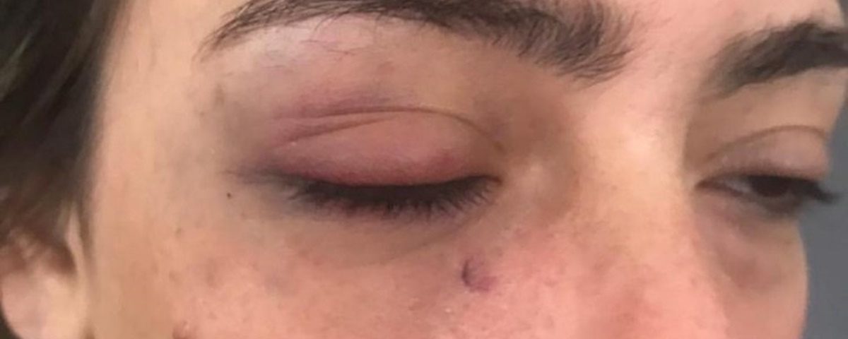 POLÍTICO DA PB NA LEI MARIA DA PENHA : Prefeito é acusado de agredir namorada a chutes, soco e xingamentos, e desembargador determina medidas protetivas